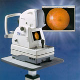 [Topcon Retinal Camera, 16Kbyte]